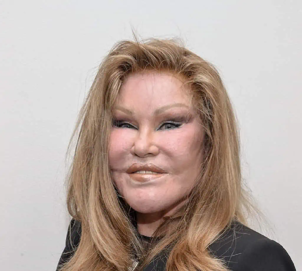 Jocelyn Wildenstein Before Plastic Surgery See Her Face Different Look